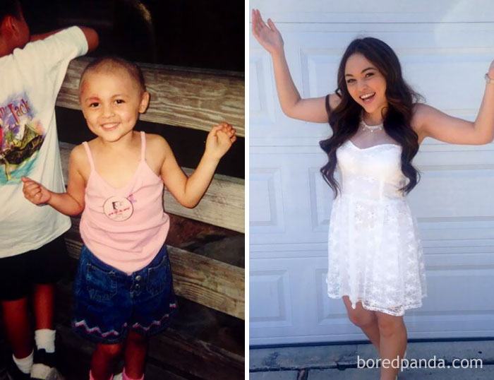 Люди, которые победили рак, в фотографиях «до и после» Люди, которые победили рак, в фотографиях «до и после»