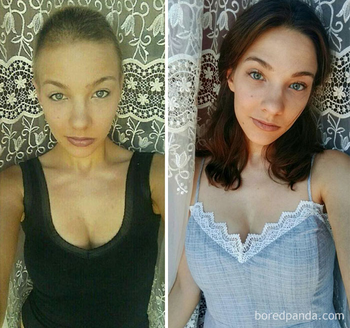 Люди, которые победили рак, в фотографиях «до и после» Люди, которые победили рак, в фотографиях «до и после»