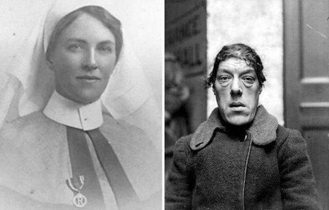 Женщина, которая нашла плюс в своем уродстве Женщина, которая нашла плюс в своем уродстве