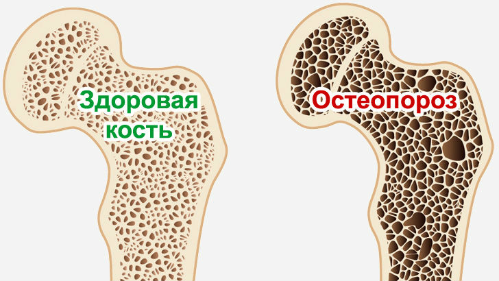 Жительнице Китая «постарела» на 30 лет из-за любви к кофе Жительнице Китая «постарела» на 30 лет из-за любви к кофе