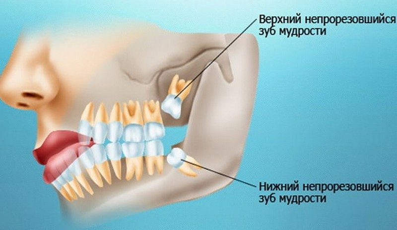 Эволюционные изменения, которые оставили загадочный след на теле человека Эволюционные изменения, которые оставили загадочный след на теле человека