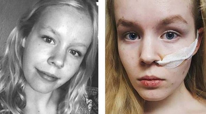 17-летняя жертва изнасилования подверглась эвтаназии