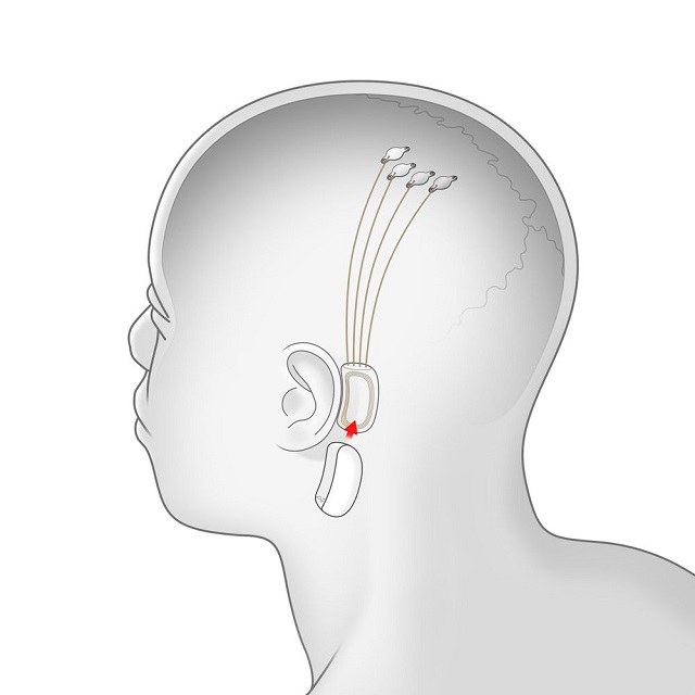 Стартап Илона Маска Neuralink представил новый нейротехнологический проект Стартап Илона Маска Neuralink представил новый нейротехнологический проект