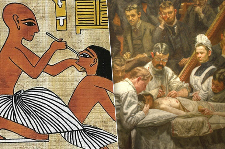 История первых пластических операций История первых пластических операций