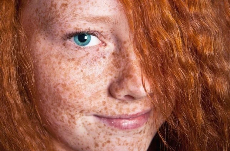 Самые редкие и необычные заболевания Самые редкие и необычные заболевания