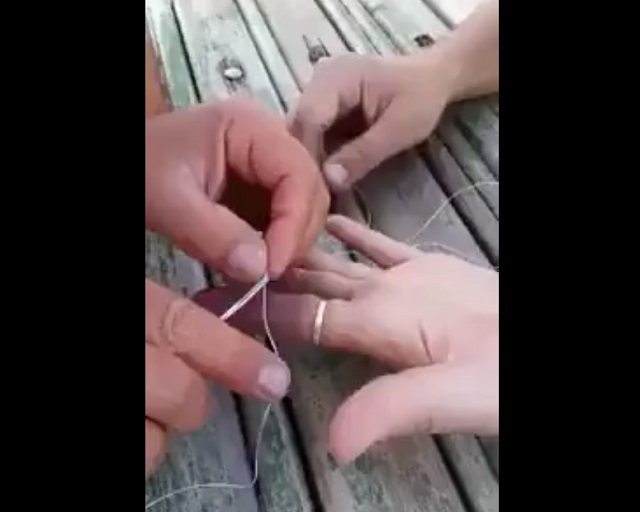 Что делать, если кольцо застряло на пальце?