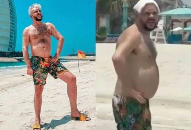 Как выглядит Филипп Киркоров без грима и фотошопа — звезду запечатлели не в лучшем виде на курорте