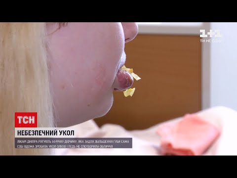14-летняя девочка вколола масло в губы