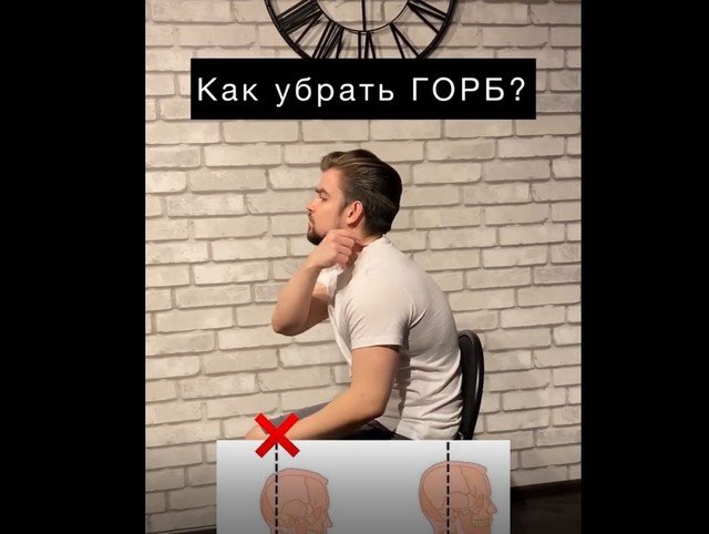 Как убрать горб из-за постоянной работы за компьютером