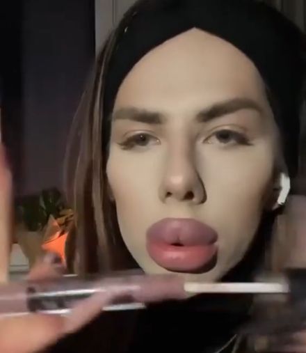 О красоте накаченных губов)⁠⁠