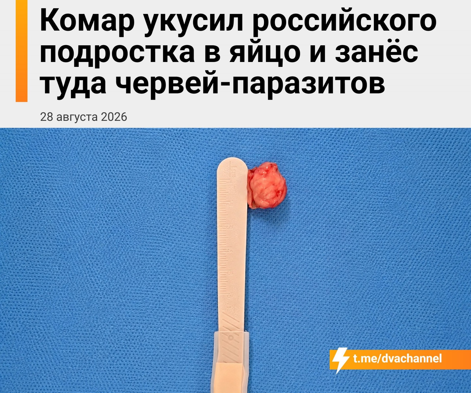 Жителю Подмосковья удалили паразитов из мошонки после укуса комара
