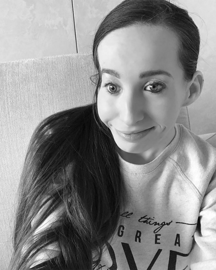 Иванка Данисова — женщина, которая родилась на свет только с одной красивой половиной лица